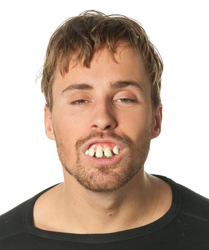 Faux-dentier